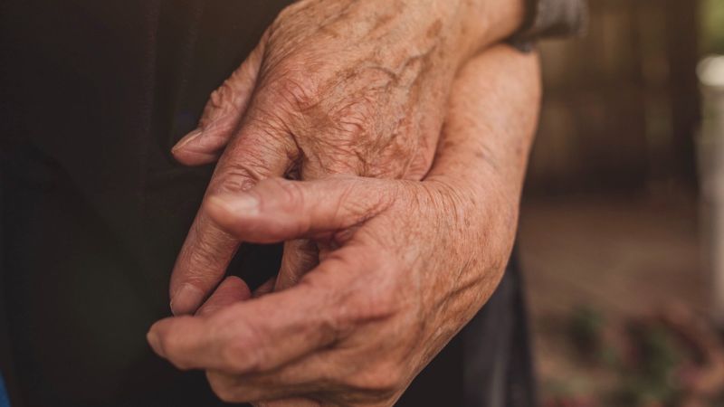 Altersflecken: Ursachen und Behandlungsmöglichkeiten