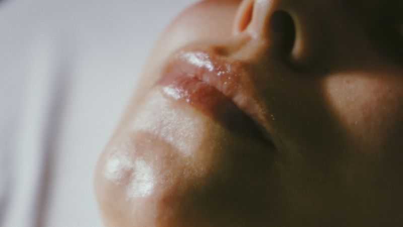 Mischhaut: Ursachen, Symptome und richtige Pflege